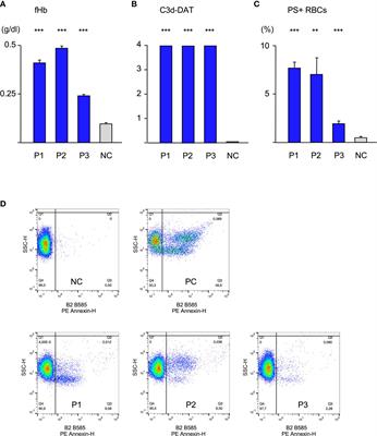 Three different pathways of IgM-antibody-dependent hemolysis are mainly regulated by complement